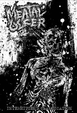 Meatal Ulcer : Intermittent Claudication